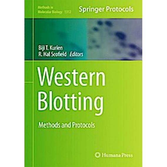 Western Blotting : Methods and Protocols