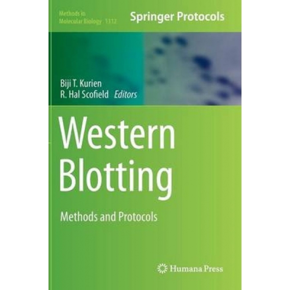 Western Blotting : Methods and Protocols