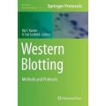 Western Blotting : Methods and Protocols