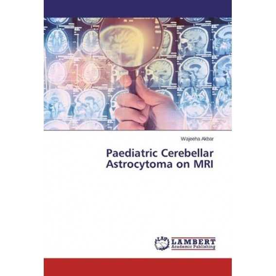 Paediatric Cerebellar Astrocytoma on MRI