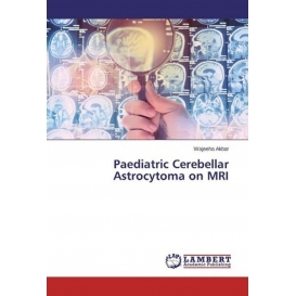 More about Paediatric Cerebellar Astrocytoma on MRI