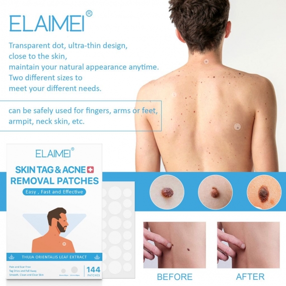 ELAIMEI Skin Tag Remover Patches 144 Stš¹ck Skin Tag Remover Pads Abdeckungen & Verdeckt Skin Tags Mole Wart Removal Patches